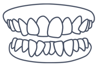 img-laiasala-maloclusions-512x356-apinyament-00