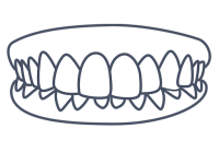 img-laiasala-maloclusions-512x356-sobremossegada-00